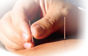 Acupuncture Treatment